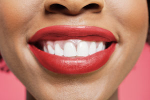 Benefits of Straightening Your Teeth
