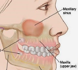 maxillary sinuses
