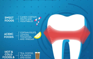 dentist in Monroe nc - tooth sensitivity