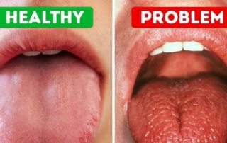 Dry mouth treatment Dentist in monroe nc